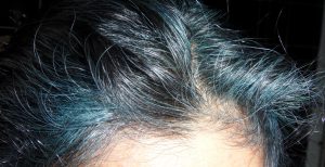 Hairline Gray Hair Gone Blue with Indigo Hair Dye
