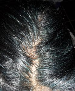 Blue Indigo Hair Roots in Gray Hair