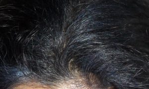 Indigo Blue hair Colour in White Hair