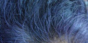Purple Indigo Dye in Grey Hairline